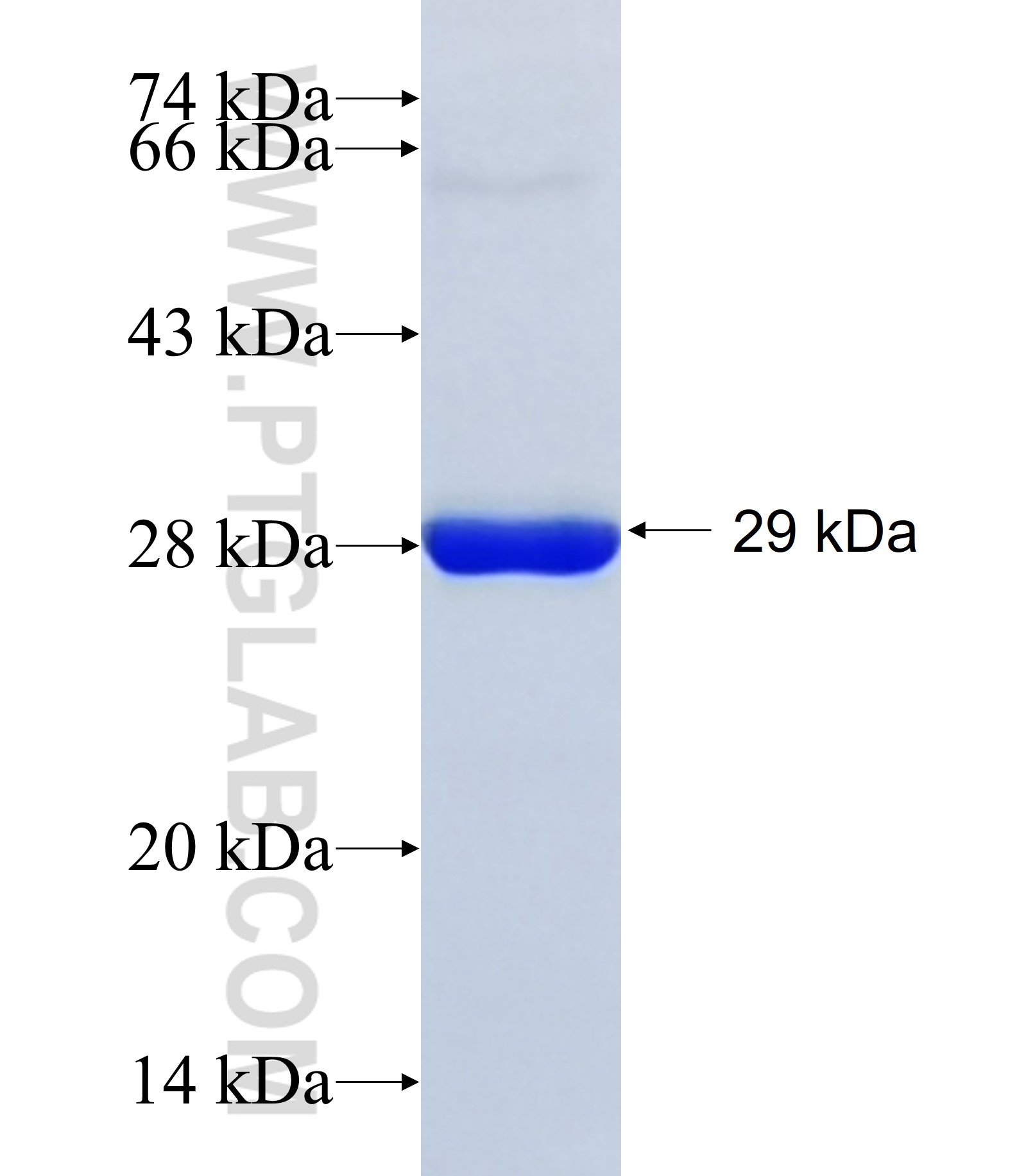 MUL1 fusion protein Ag9391 SDS-PAGE MUL1 fusion protein Ag9391 SDS-PAGE