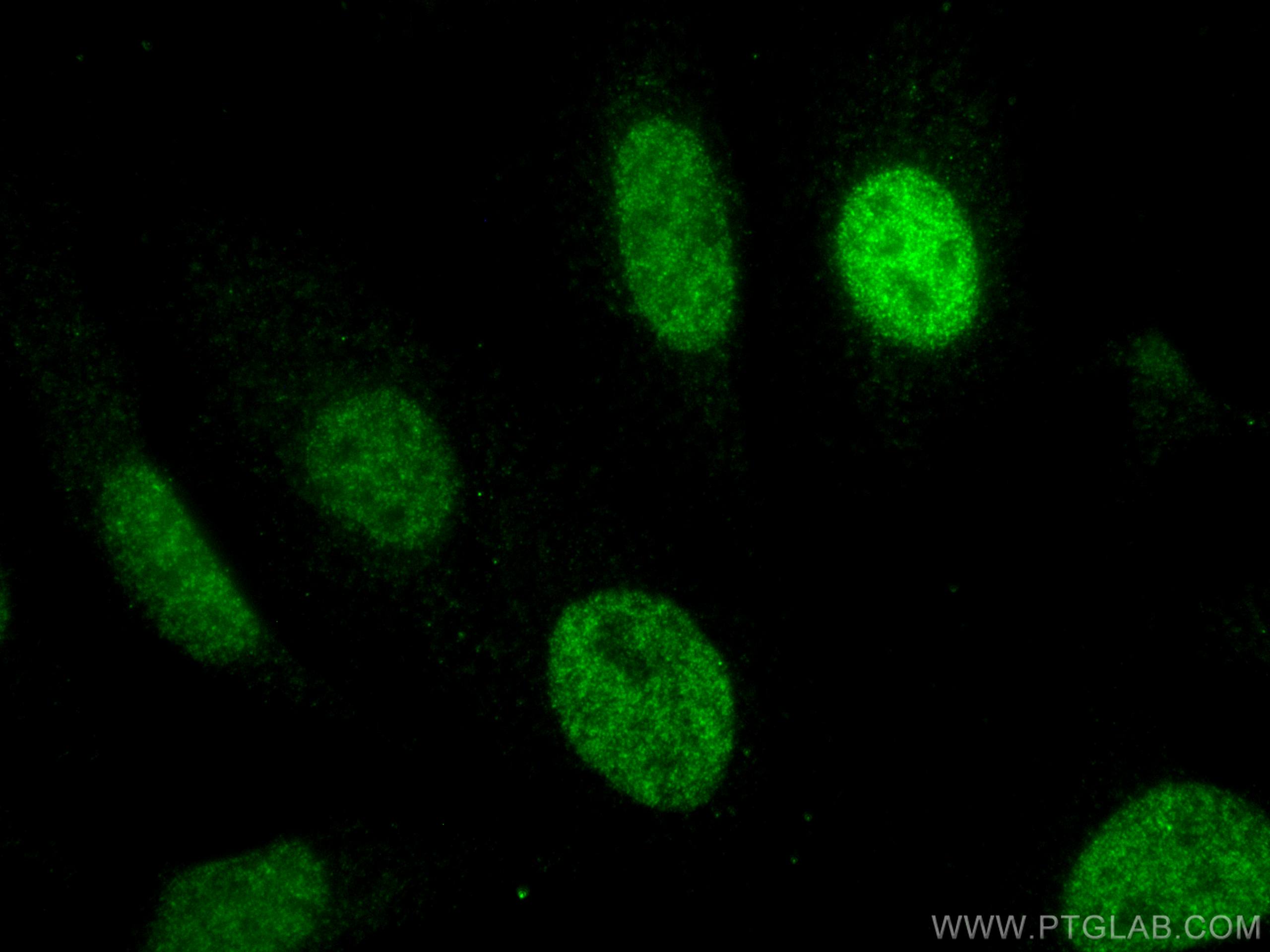 IF Staining of HeLa using 60353-1-Ig