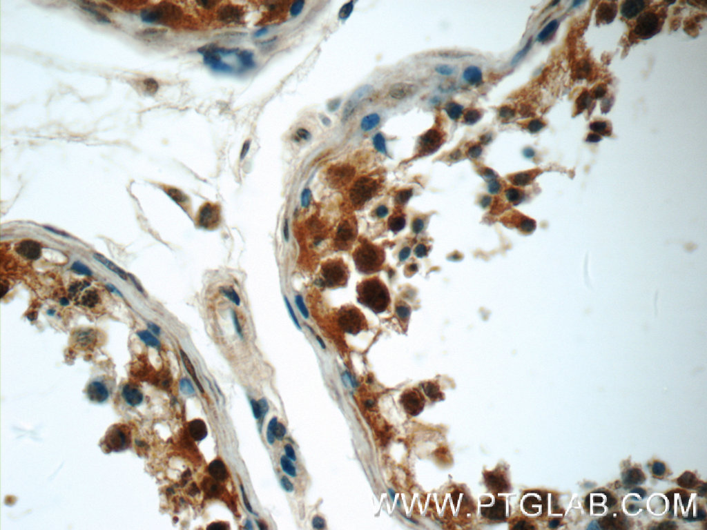 IHC staining of human testis using 24762-1-AP