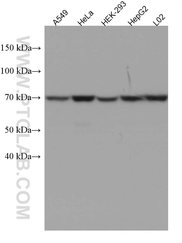 WB analysis using 67351-1-Ig