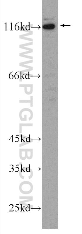 WB analysis of Jurkat using 22112-1-AP