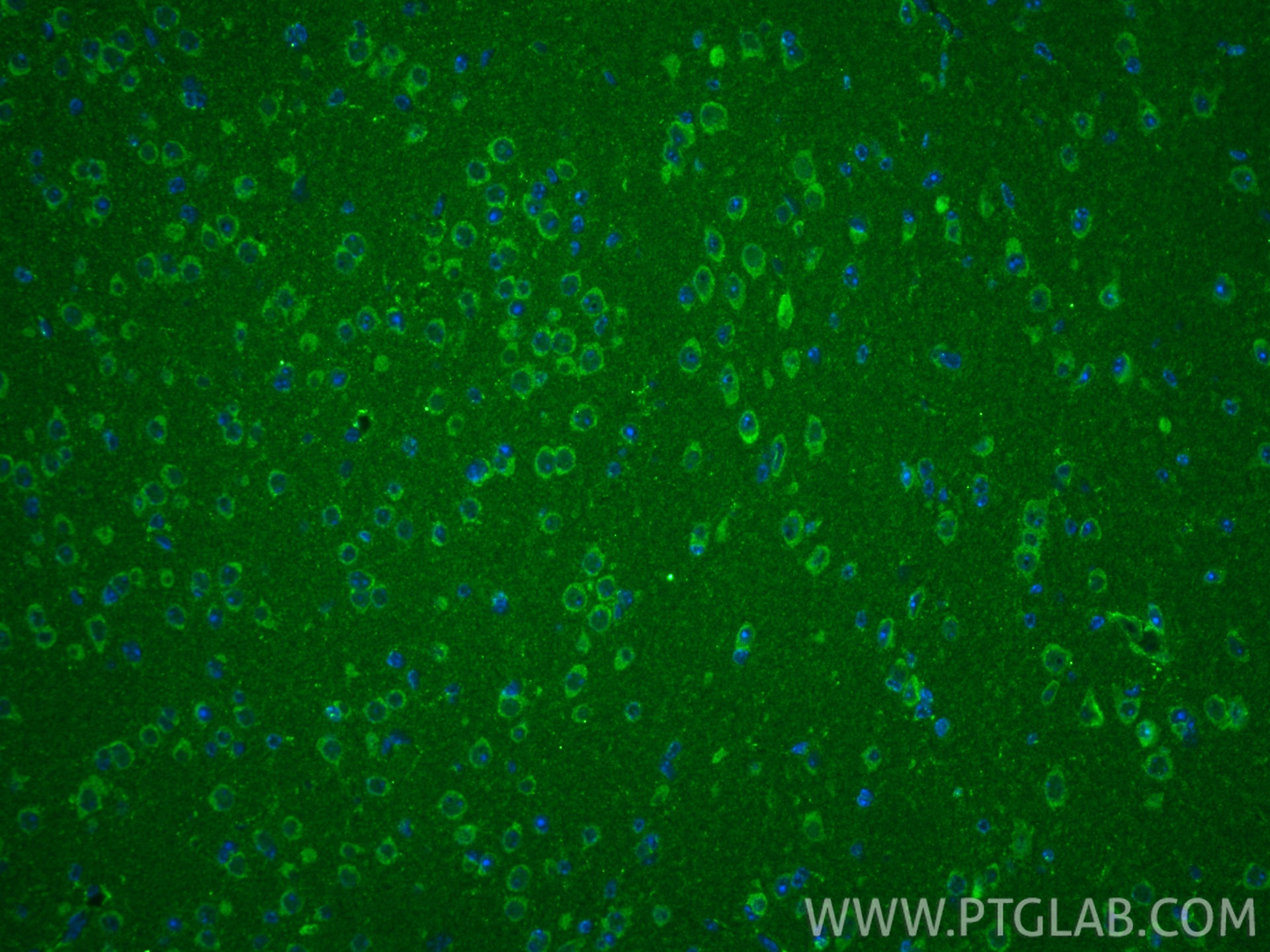 IF Staining of mouse brain using 17034-1-AP IF Staining of mouse brain using 17034-1-AP