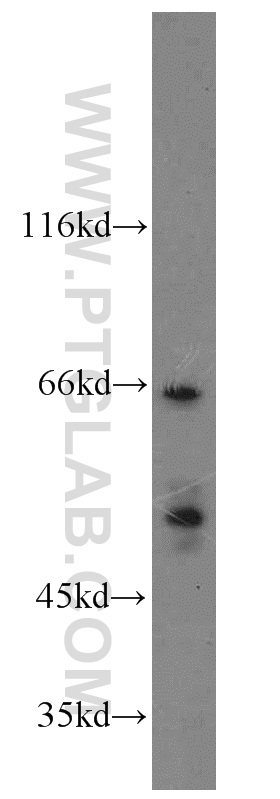 WB analysis of K-562 using 15237-1-AP