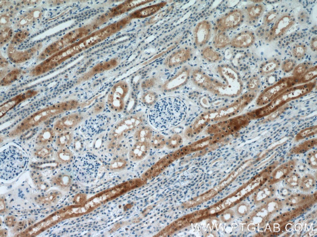 MUTYH Polyclonal antibody