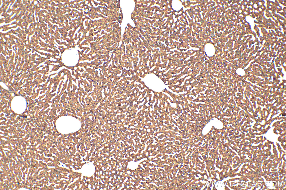 IHC staining of mouse liver using 19650-1-AP