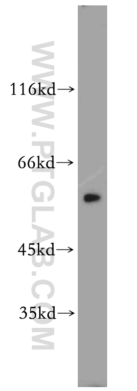 WB analysis of HeLa using 19650-1-AP