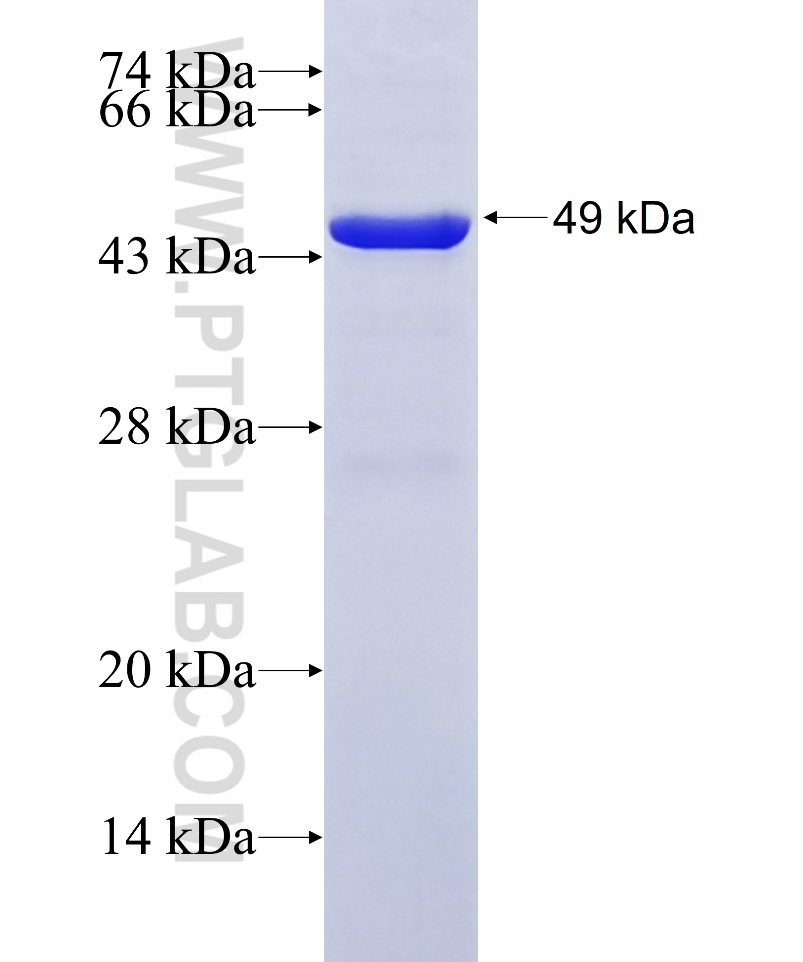 MVD fusion protein Ag7576 SDS-PAGE MVD fusion protein Ag7576 SDS-PAGE