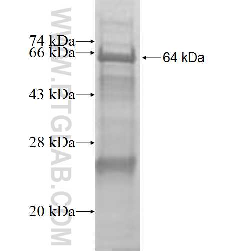 MVP fusion protein Ag9366 SDS-PAGE MVP fusion protein Ag9366 SDS-PAGE
