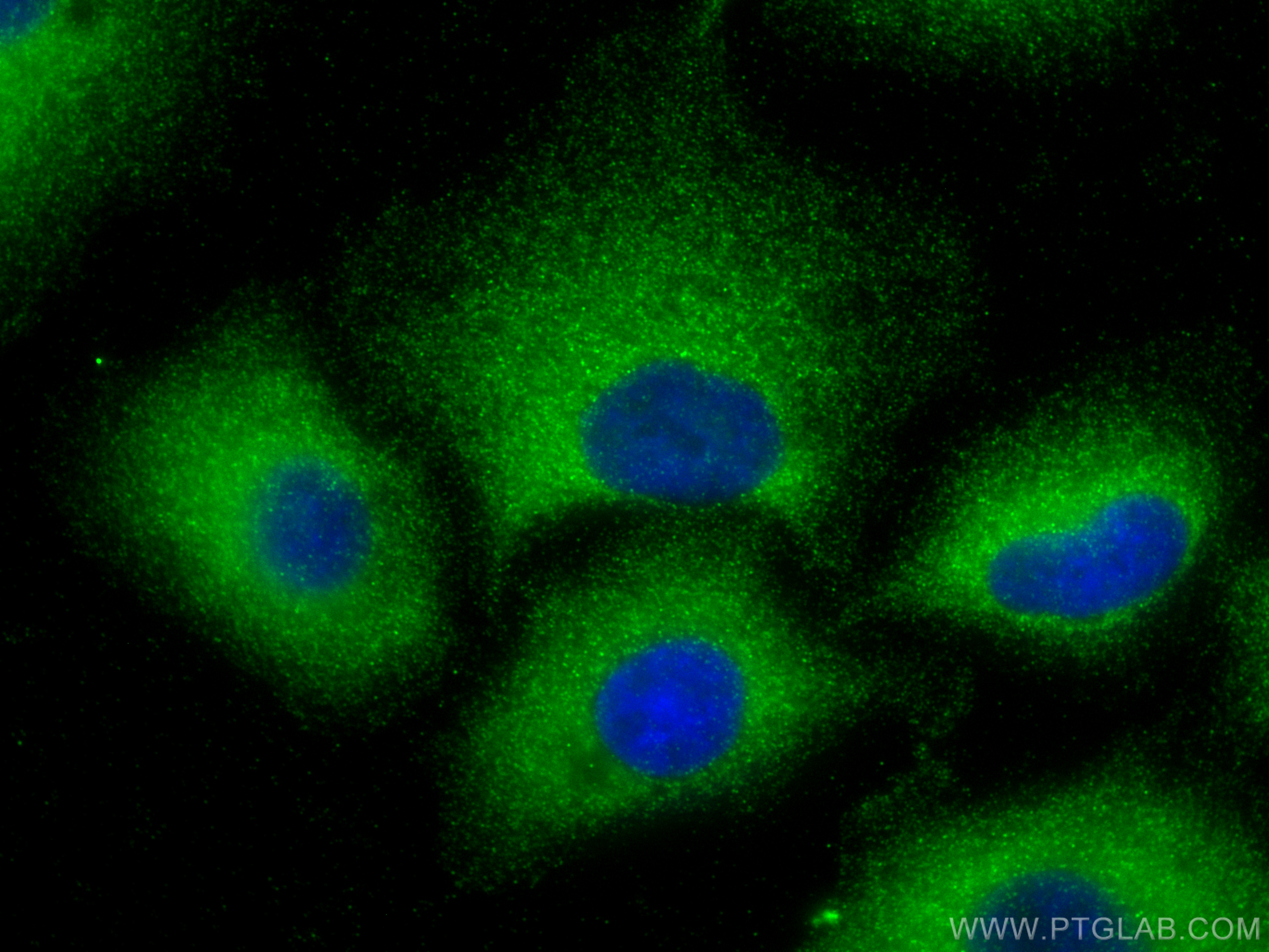 IF Staining of A549 using 13750-1-AP