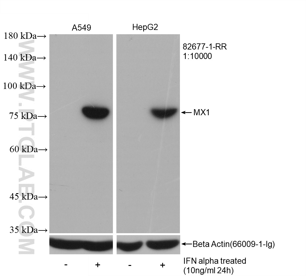 WB analysis using 82677-1-RR