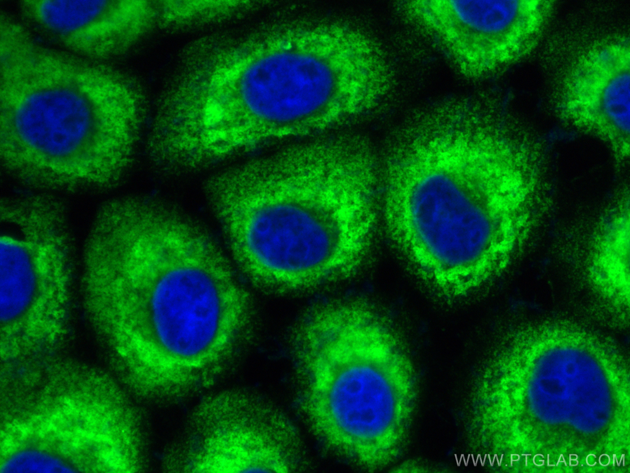 IF Staining of A431 using CL488-82677