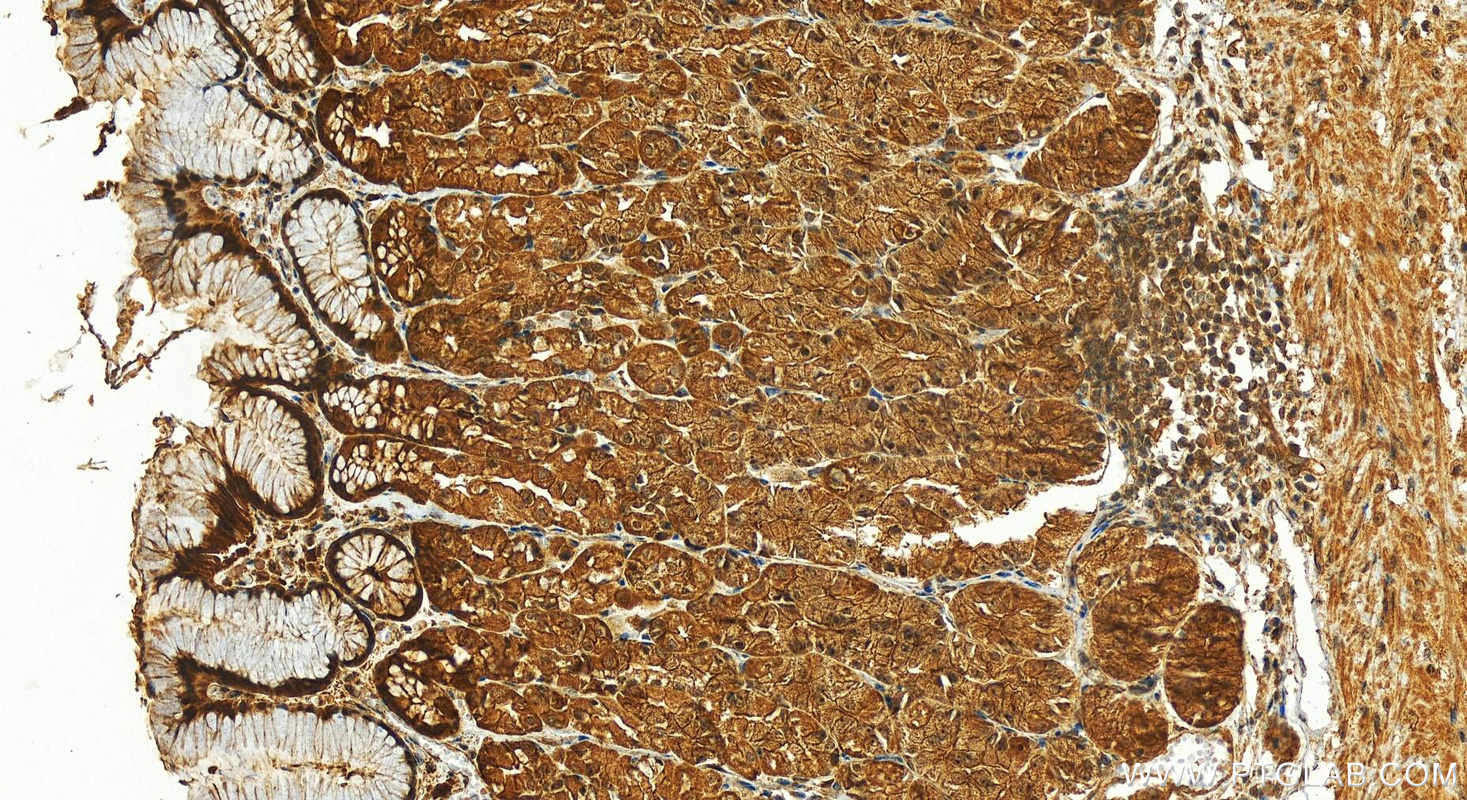 IHC staining of human stomach using 13278-1-AP