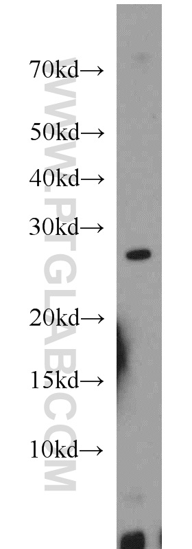 WB analysis of mouse skeletal muscle using 17888-1-AP