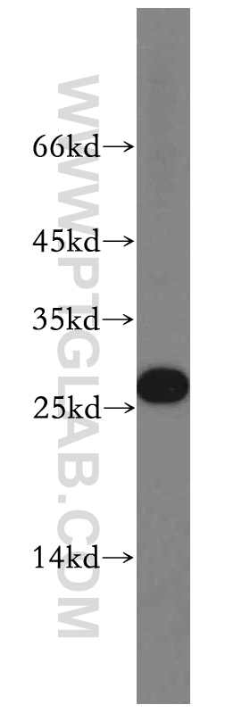 WB analysis of HepG2 using 19547-1-AP