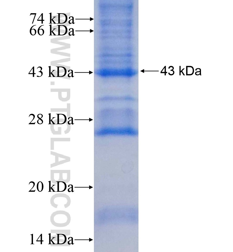 MXD3 fusion protein Ag0104 SDS-PAGE MXD3 fusion protein Ag0104 SDS-PAGE