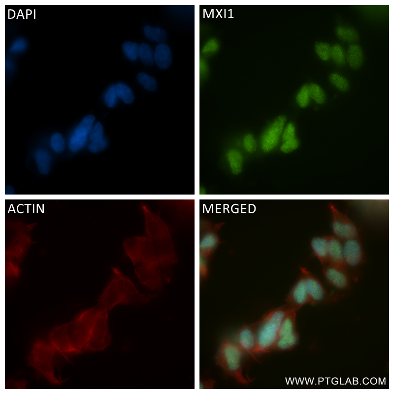 IF Staining of SH-SY5Y using 84733-6-RR (same clone as 84733-6-PBS)