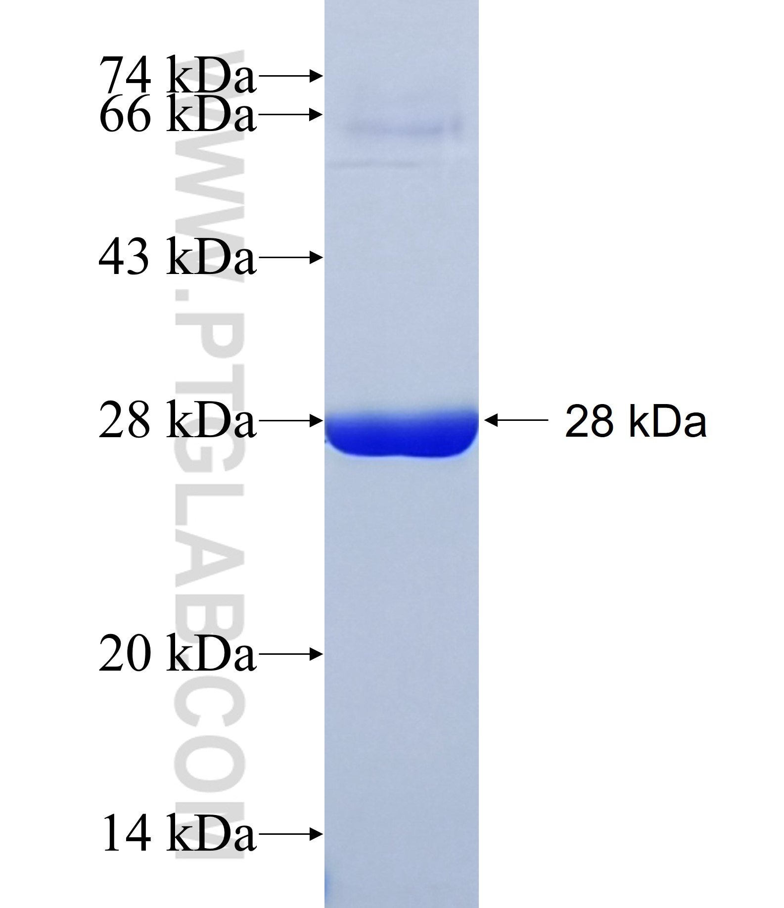 MXRA5 fusion protein Ag31164 SDS-PAGE