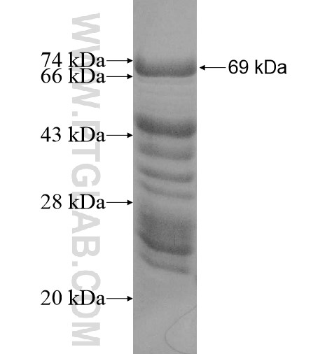 MYB fusion protein Ag11790 SDS-PAGE MYB fusion protein Ag11790 SDS-PAGE