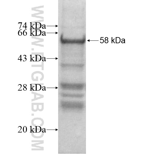 MYBL1 fusion protein Ag16010 SDS-PAGE MYBL1 fusion protein Ag16010 SDS-PAGE