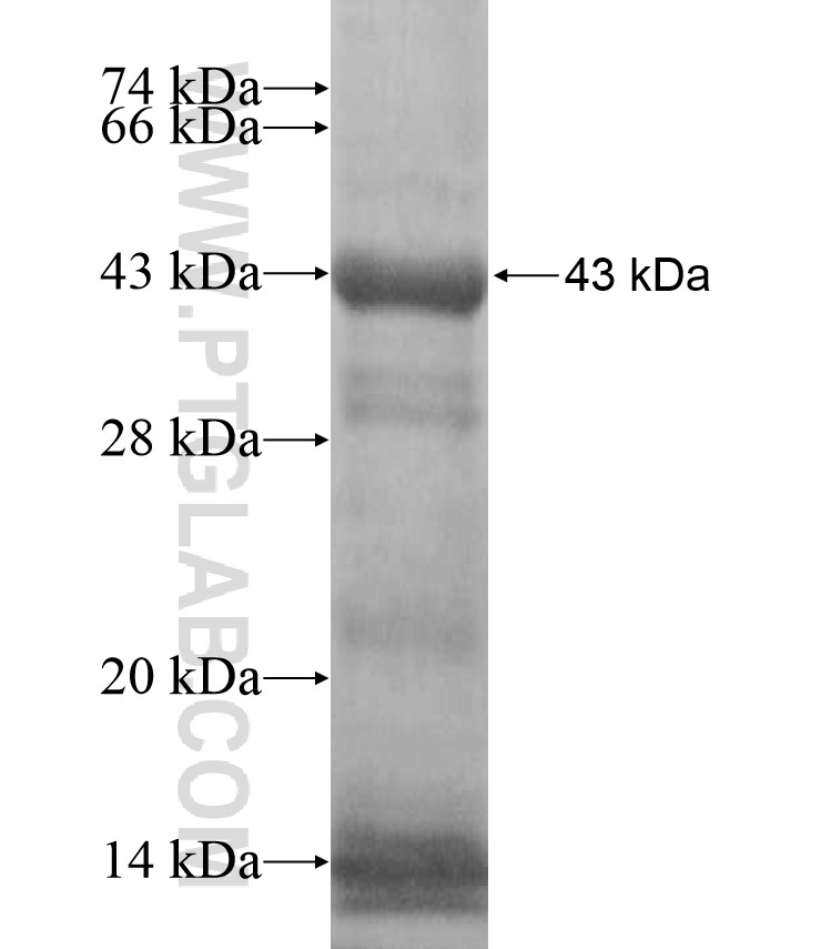MYBL1 fusion protein Ag17095 SDS-PAGE MYBL1 fusion protein Ag17095 SDS-PAGE