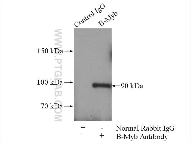 IP experiment of HeLa using 18896-1-AP