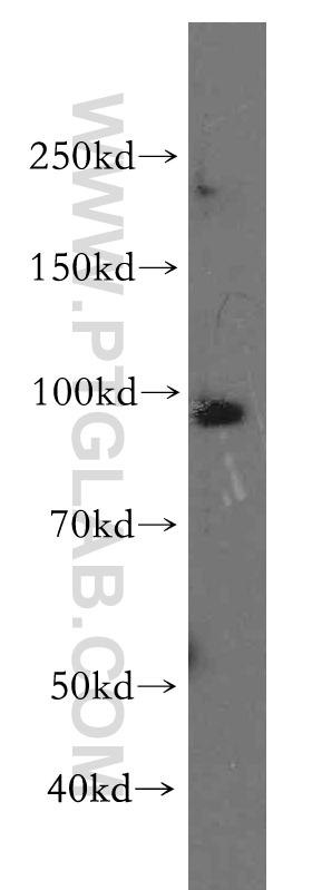 WB analysis of HeLa using 18896-1-AP