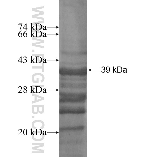 MYBL2 fusion protein Ag13484 SDS-PAGE MYBL2 fusion protein Ag13484 SDS-PAGE