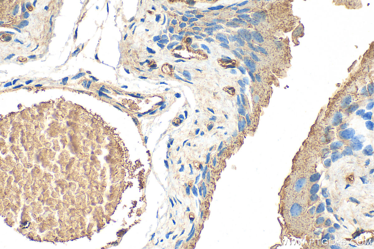 IHC staining of mouse bladder using 22900-1-AP