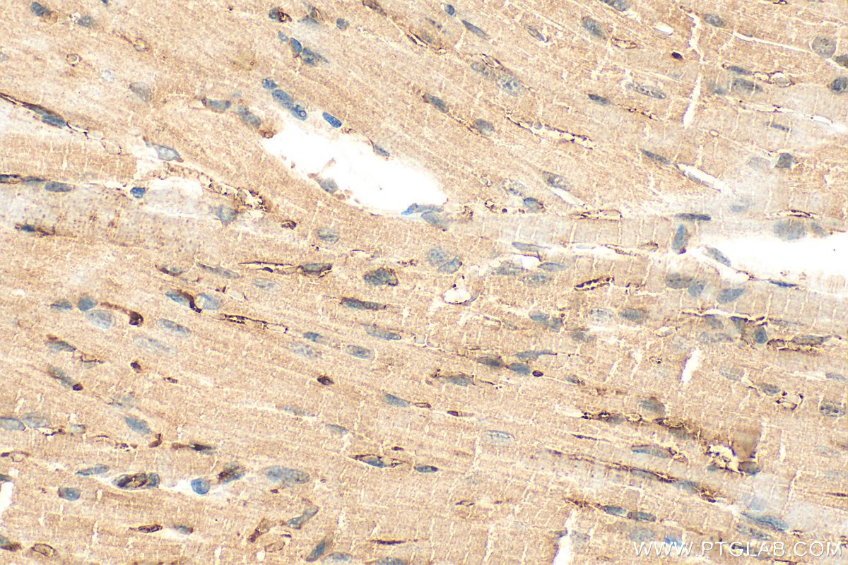 IHC staining of mouse heart using 22900-1-AP