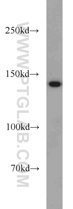 WB analysis of mouse skeletal muscle using 22900-1-AP