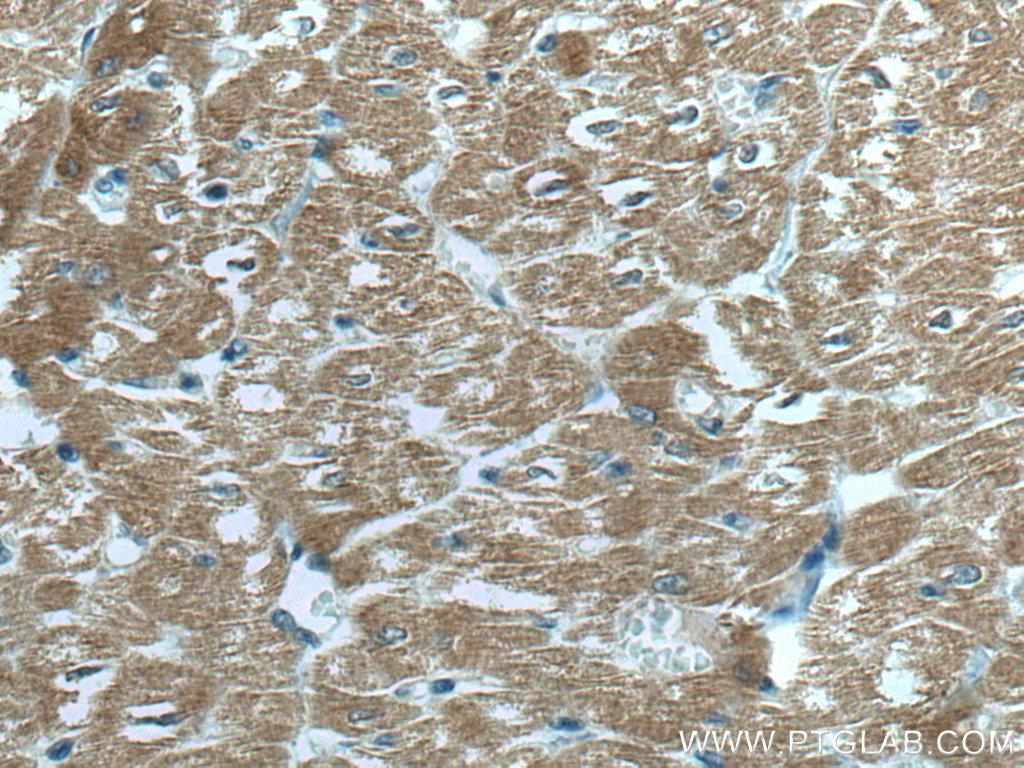 IHC staining of human heart using 67608-1-Ig (same clone as 67608-1-PBS)