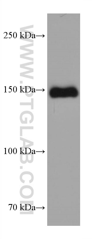 WB analysis of mouse heart using 67608-1-Ig (same clone as 67608-1-PBS)