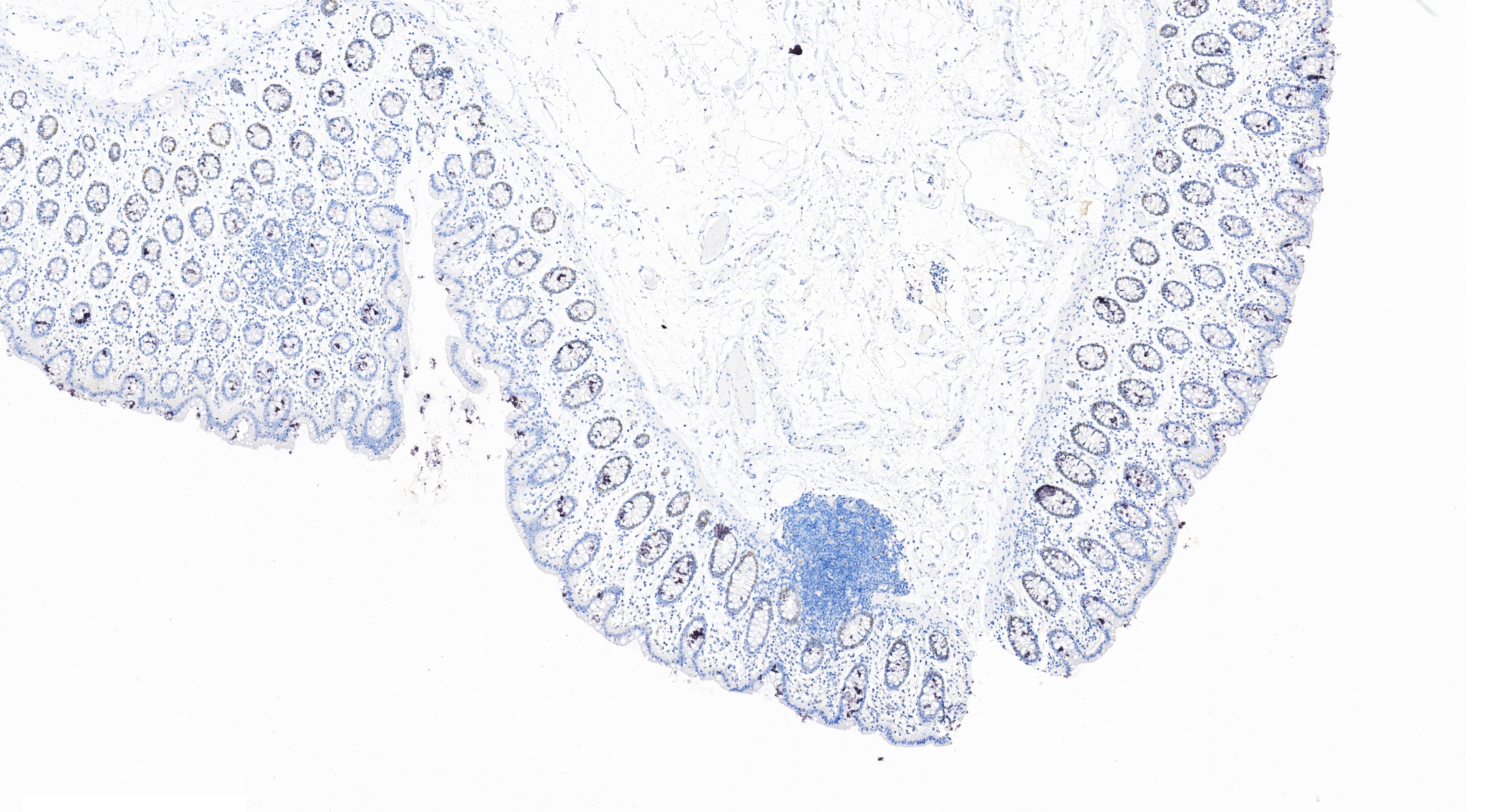 IHC staining of human colon using 80845-1-RR