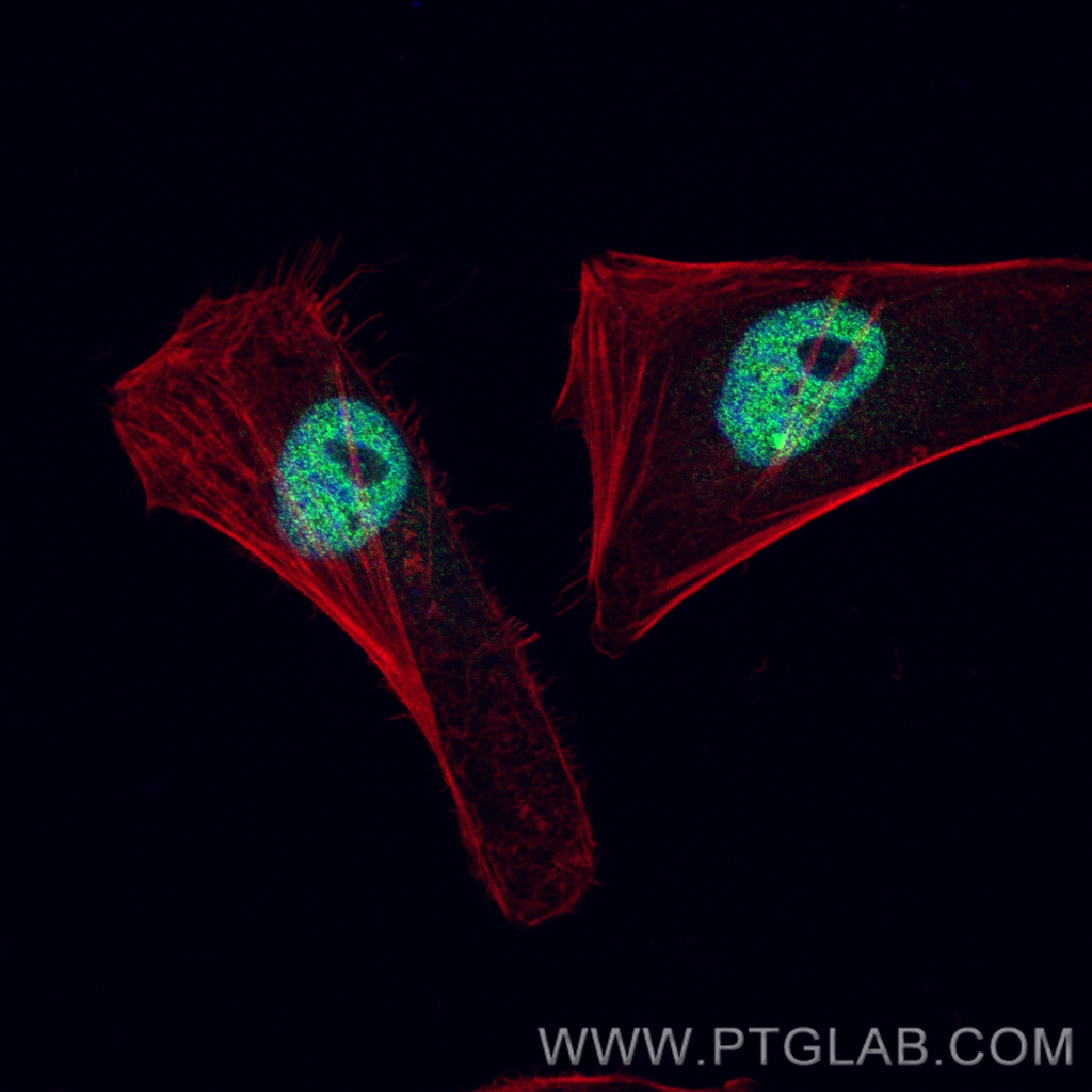 IF Staining of HeLa using 80845-1-RR