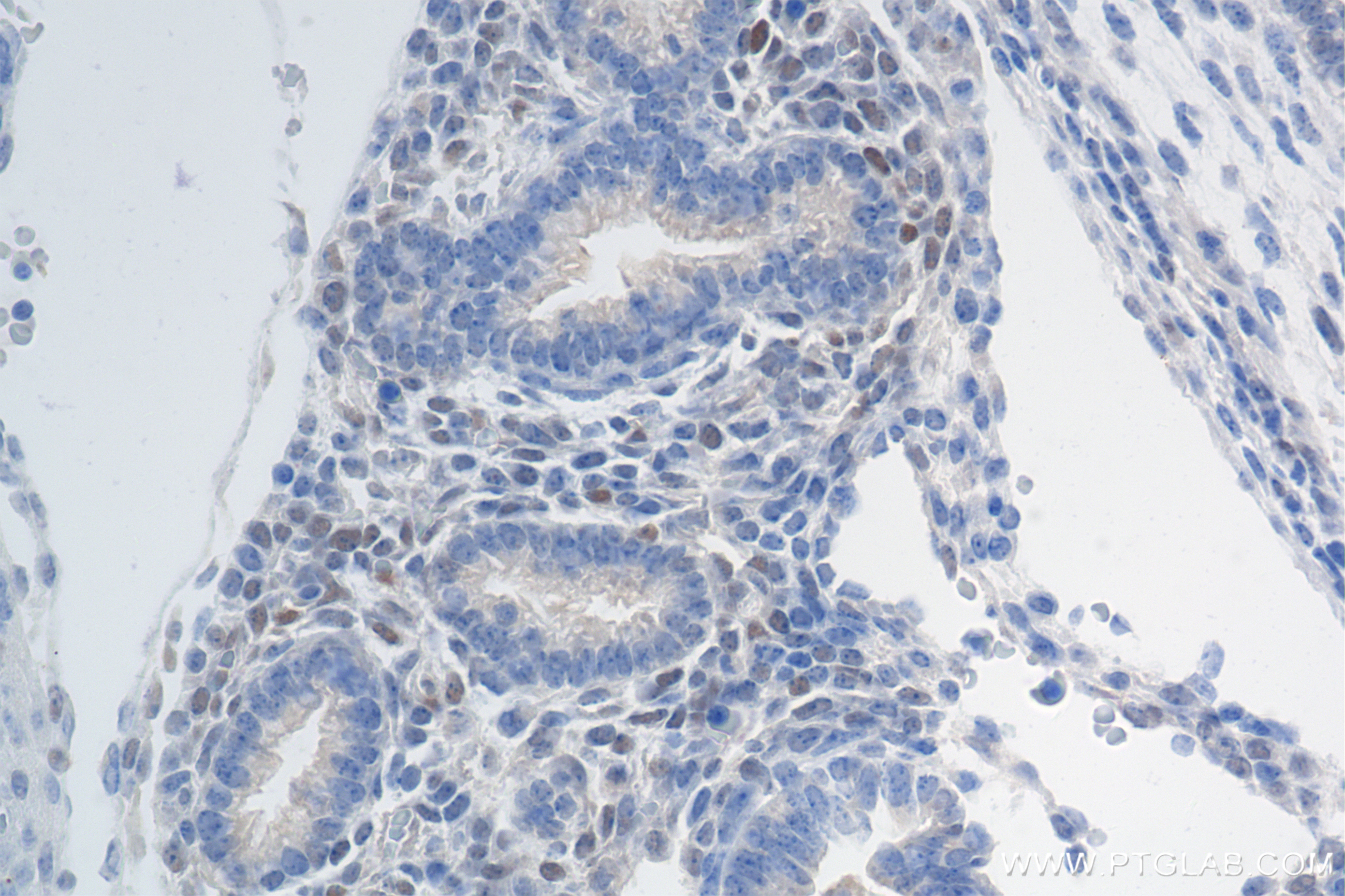 IHC staining of mouse embryo using 80845-1-RR