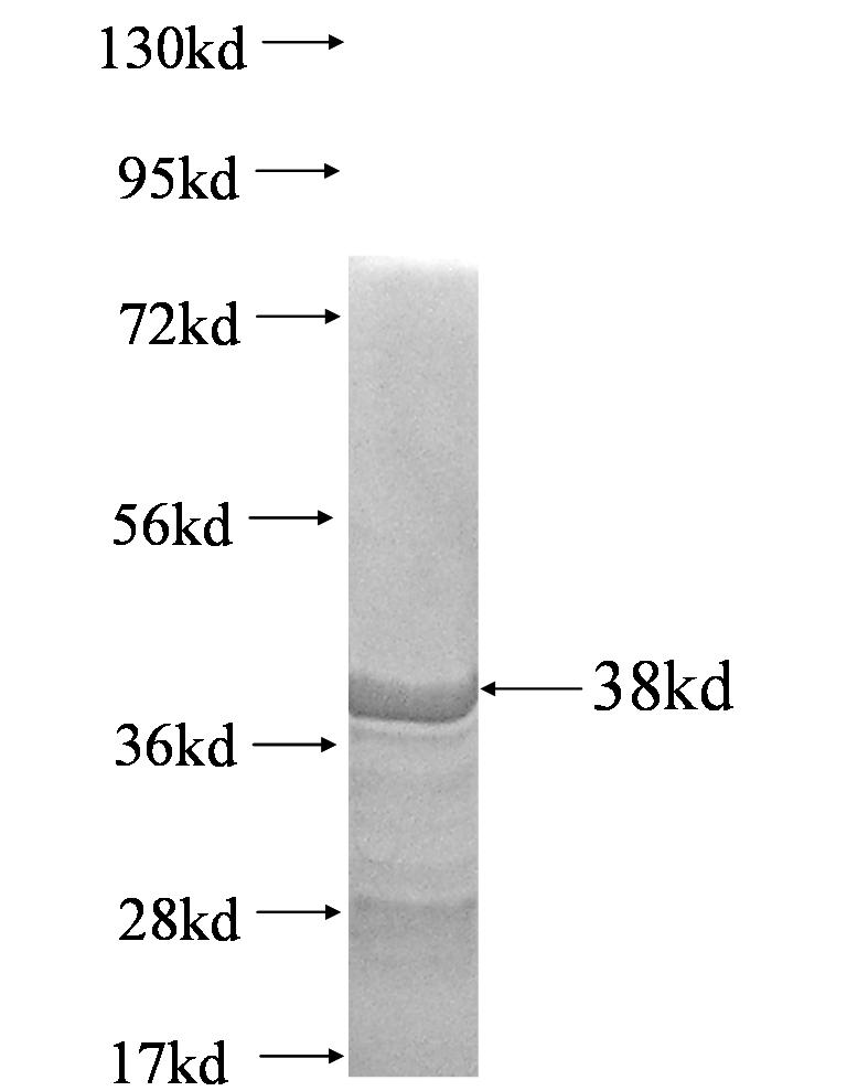 MYC fusion protein Ag1462 SDS-PAGE MYC fusion protein Ag1462 SDS-PAGE