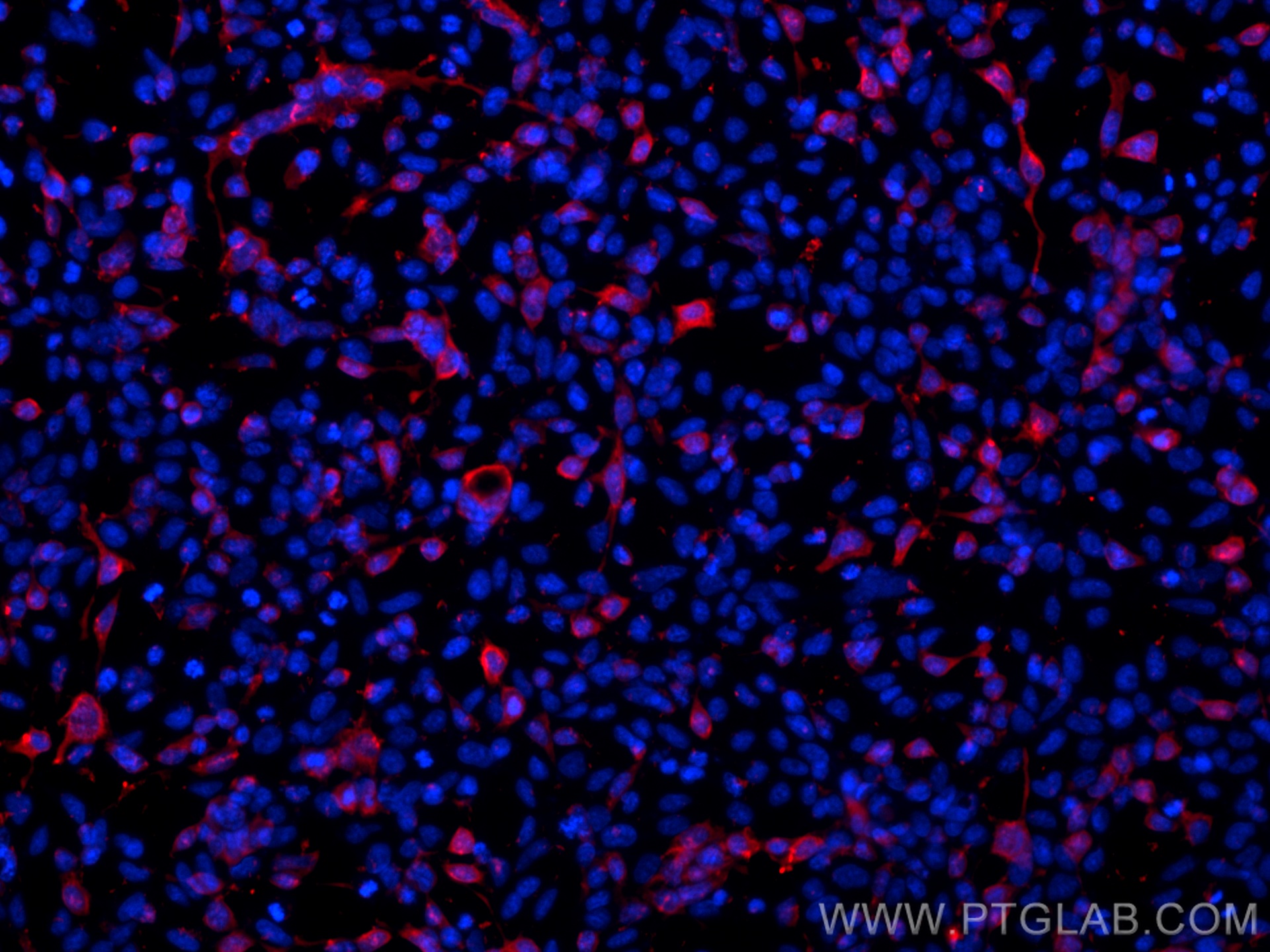 IF Staining of Transfected HEK-293 using 16286-1-AP