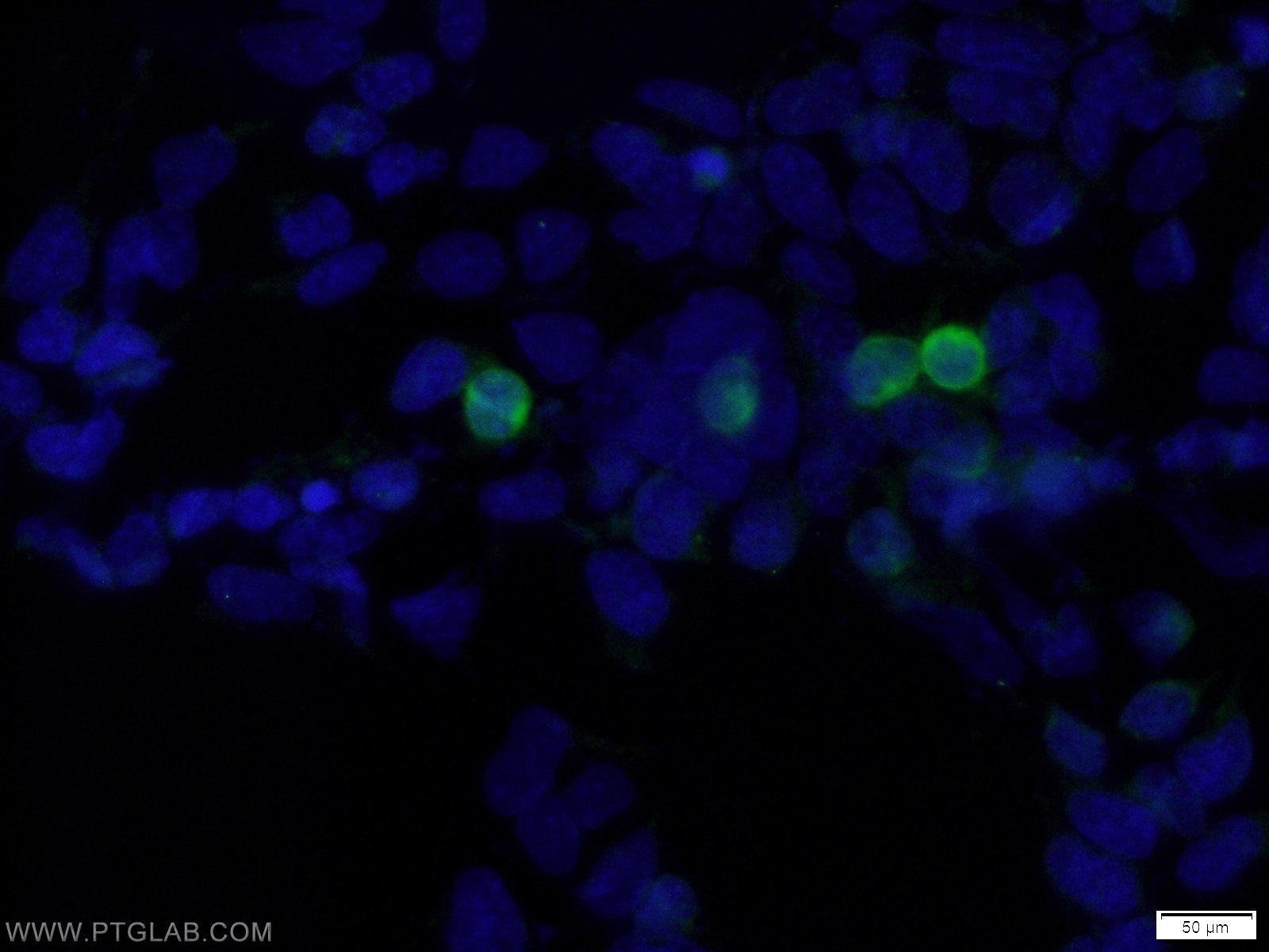 IF Staining of Transfected HEK-293 using 16286-1-AP