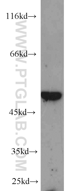 WB analysis of Recombinant protein using 16286-1-AP