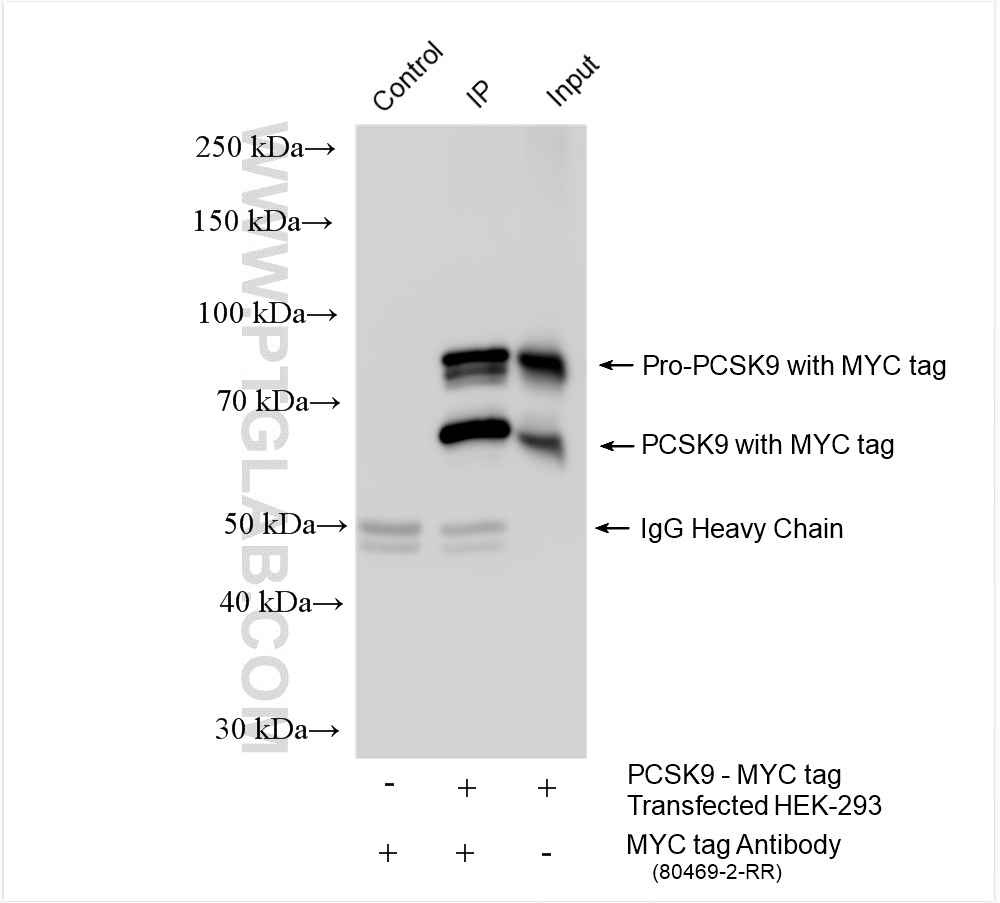 IP experiment of Transfected HEK-293 using 80469-2-RR
