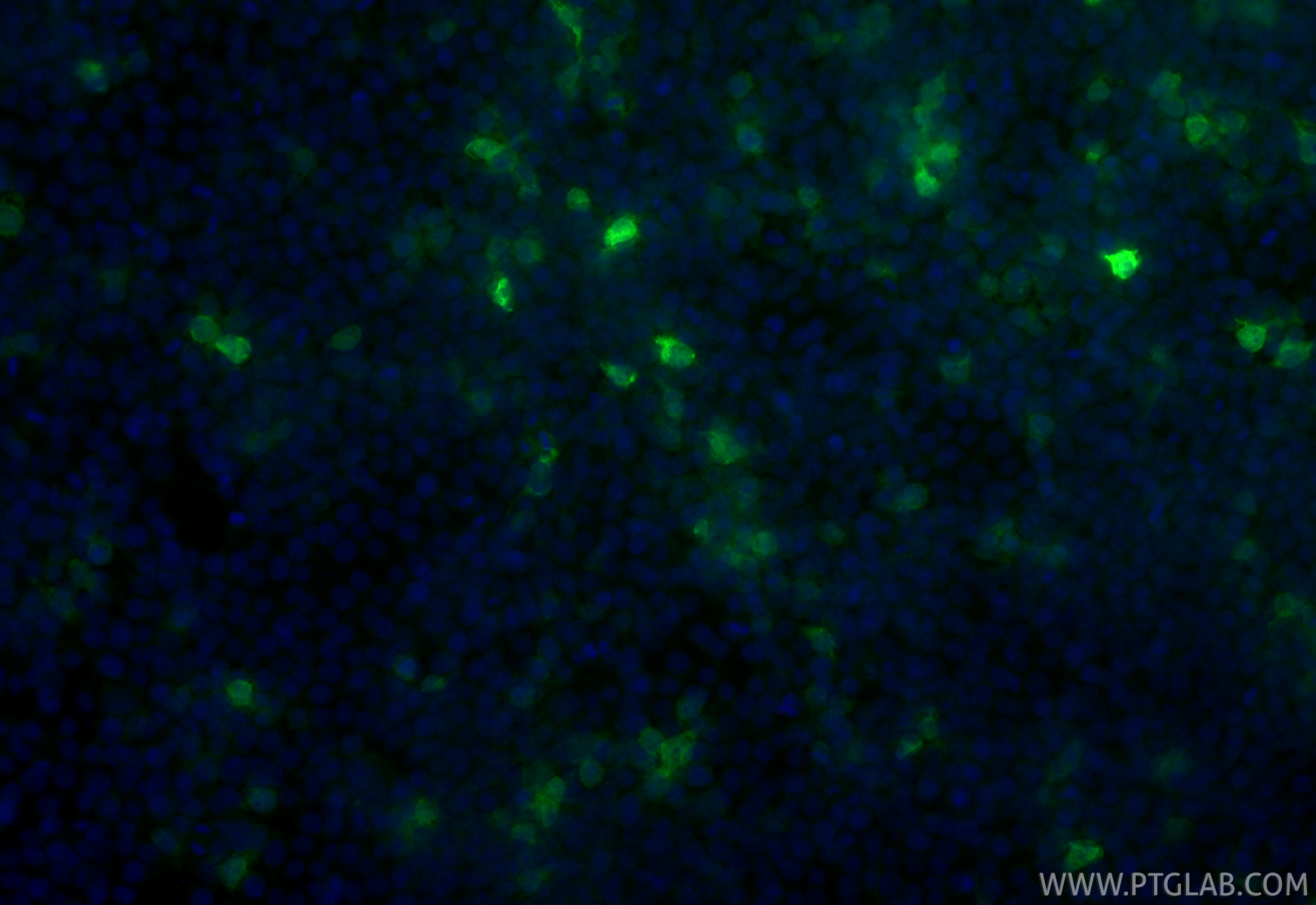 Immunofluorescent analysis of (-20°C Ethanol) fixed Transfected HEK-293 cells using CoraLite® Plus 488 MYC tag antibody (CL488-80469-2, Clone: 241611D1 ) at dilution of 1:200. IF Staining of Transfected HEK-293 using CL488-80469-2