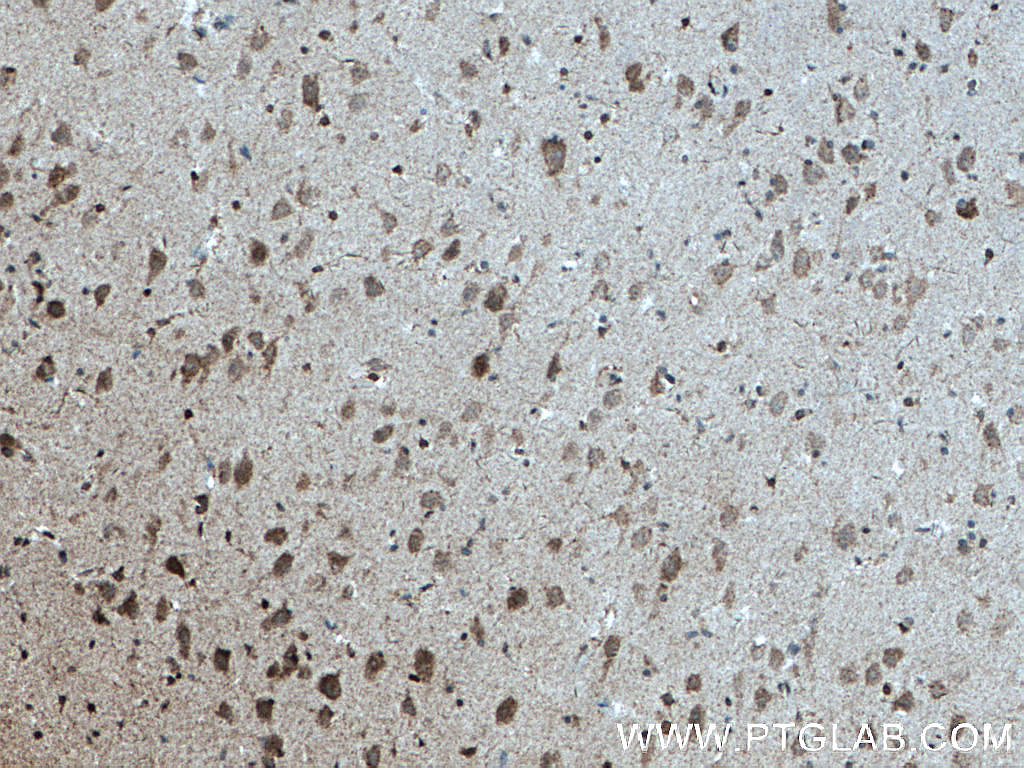 IHC staining of human brain using 27951-1-AP