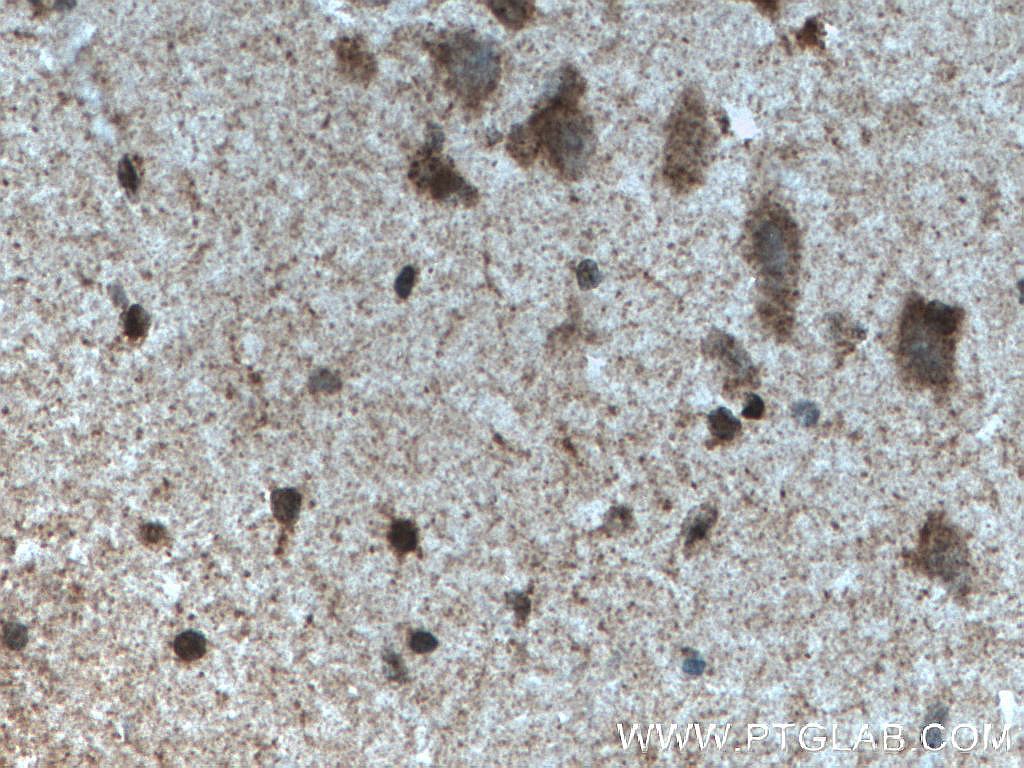 IHC staining of human brain using 27951-1-AP