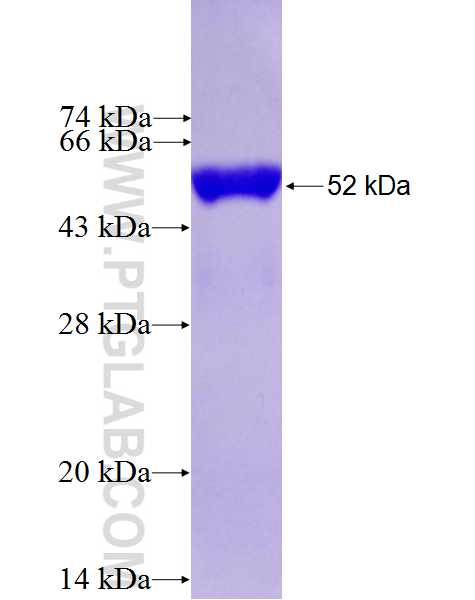 MYCBP2 fusion protein Ag27228 SDS-PAGE