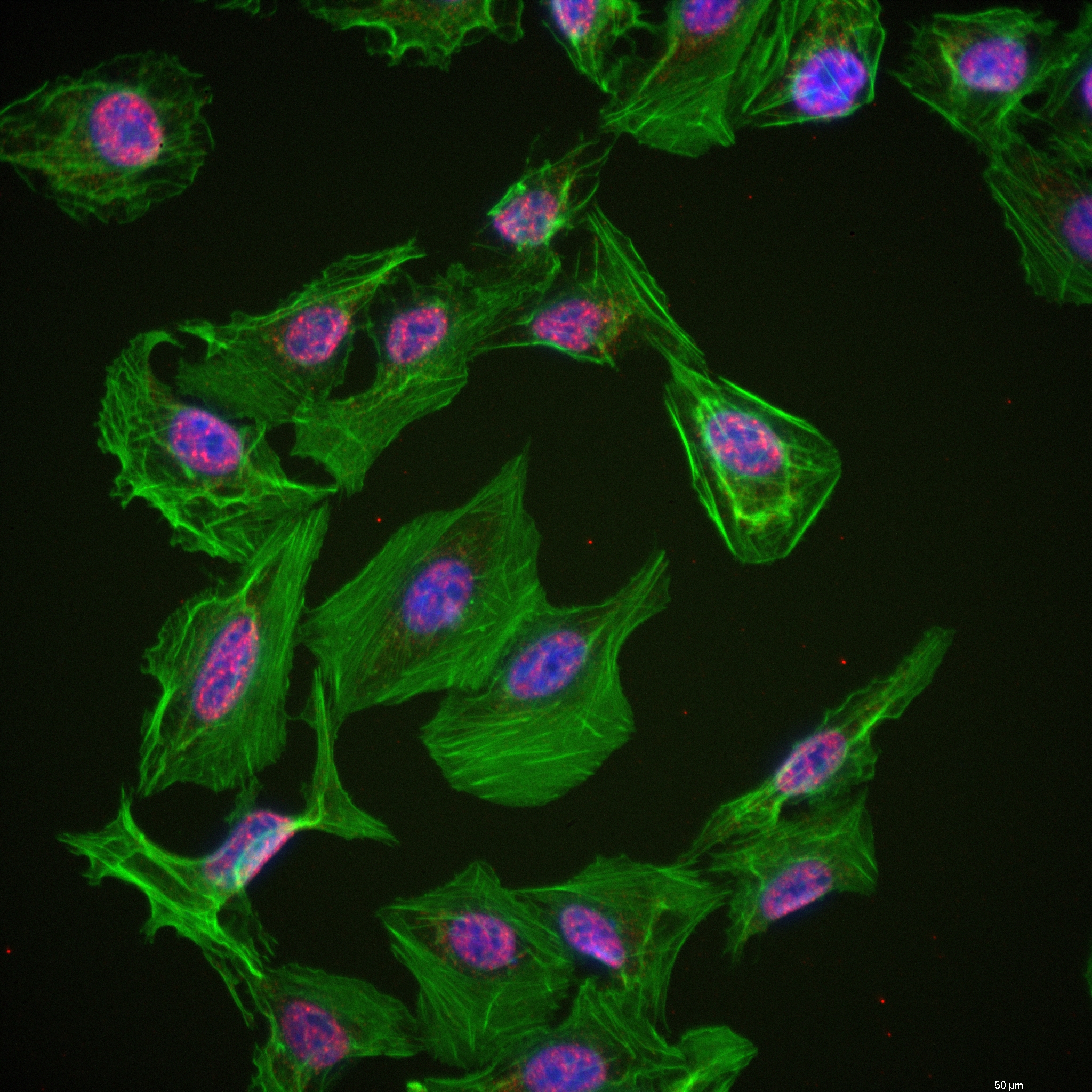 IF Staining of U2OS using 82881-1-RR (same clone as 82881-1-PBS)