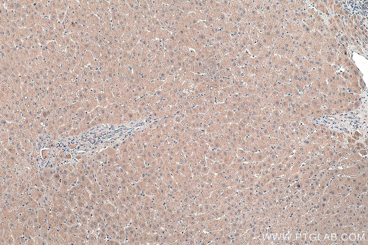 IHC staining of human liver using 67969-1-Ig