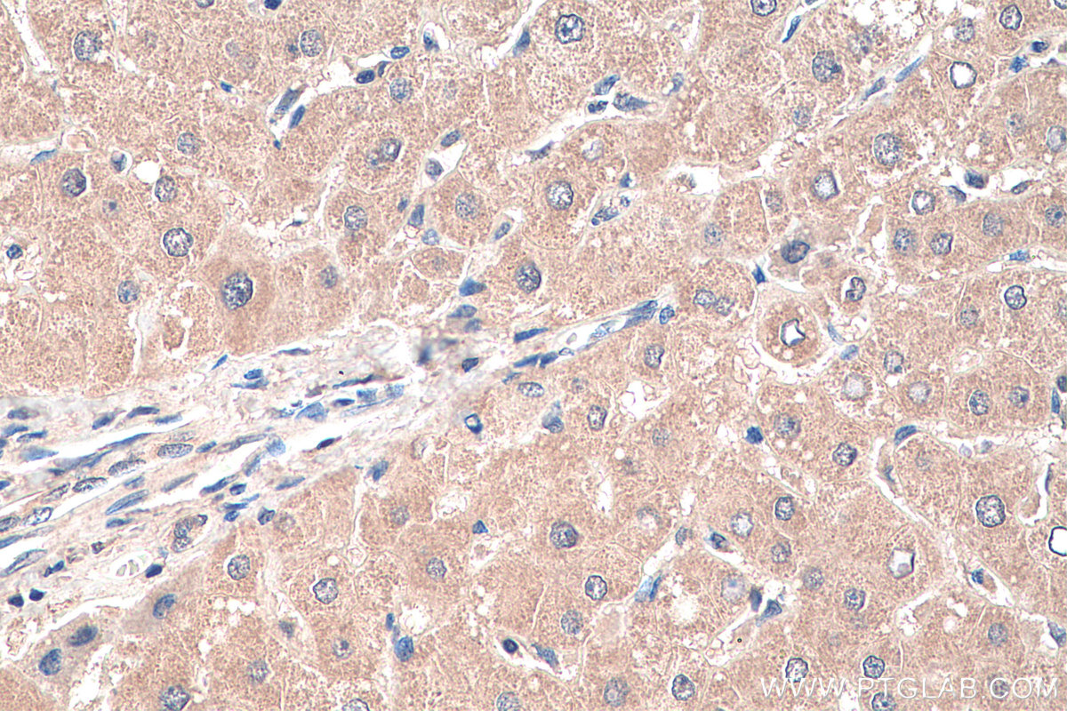 IHC staining of human liver using 67969-1-Ig