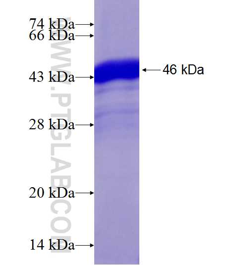 MYD88 fusion protein Ag19770 SDS-PAGE