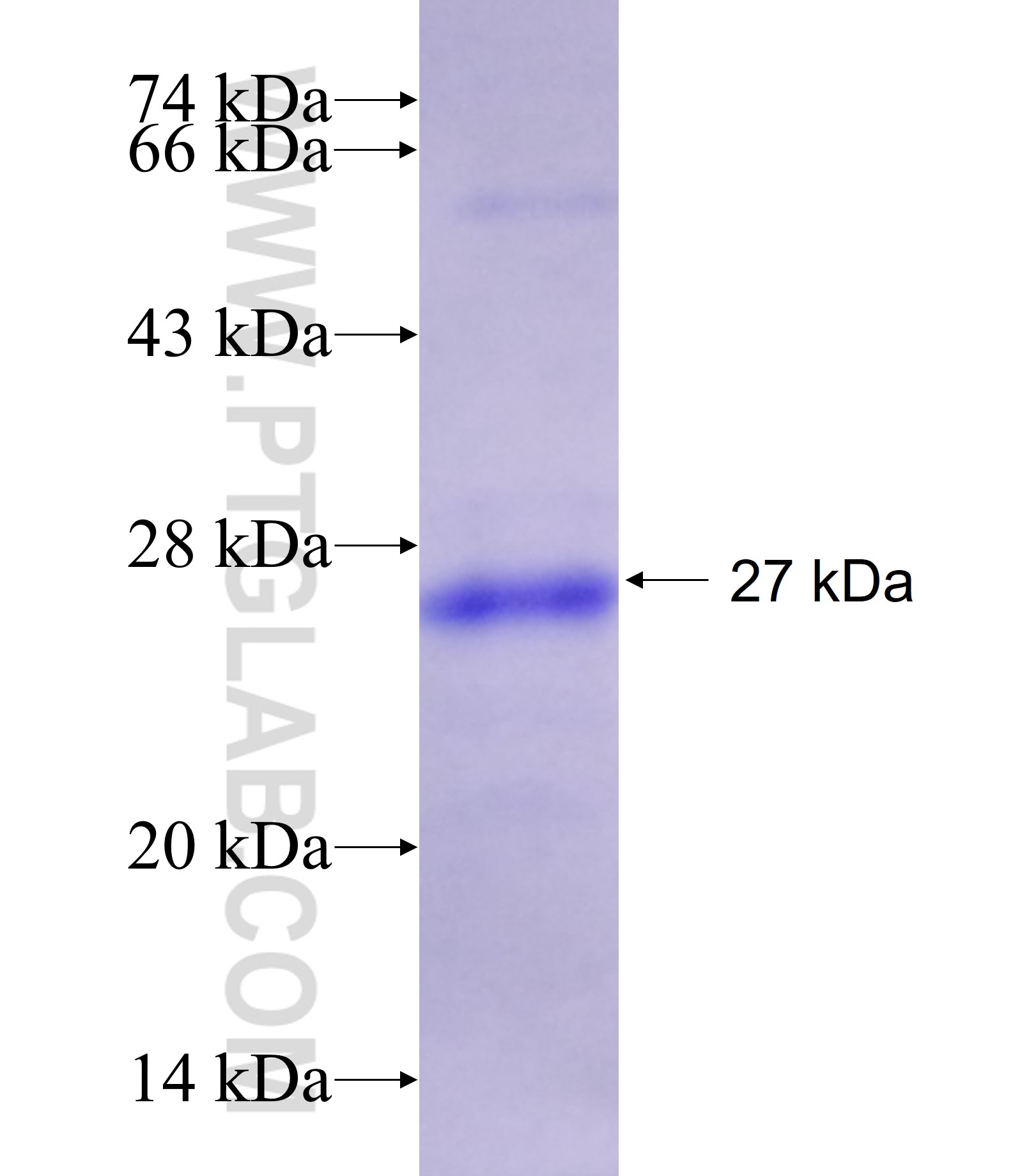 MYD88 fusion protein Ag19782 SDS-PAGE