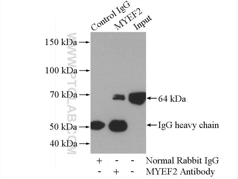 IP experiment of Jurkat using 16051-1-AP